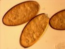 تخم فاسیولا - Egg capsule of Fasciola Hepatica