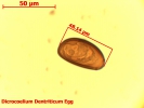 تخم دیکروسلیوم - Egg of Dicrocoelium Dentriticum