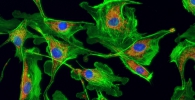 Fluorescence imaging of BPAE cell by DigiRetina 16
