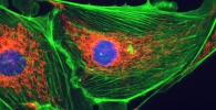 Fluorescence imaging of BPAE cell by DigiRetina 16