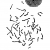 کاریوتایپ کروموزوم های انسان - Karyotype