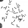 کاریوتایپ کروموزوم های انسان - Karyotype